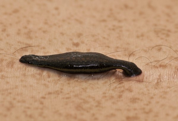 Leech on skin