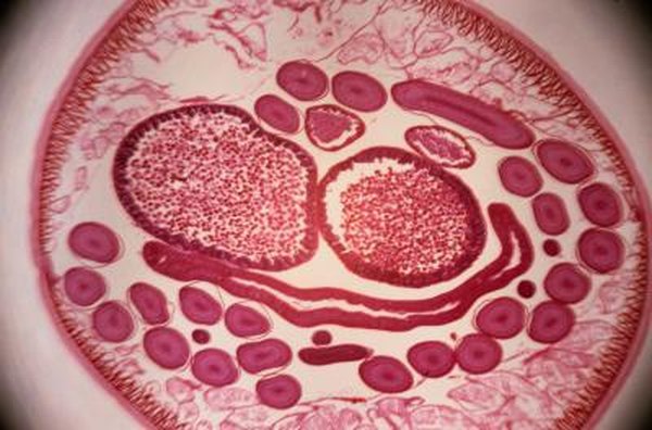 Nematodes In Soil Home Guides Sf Gate