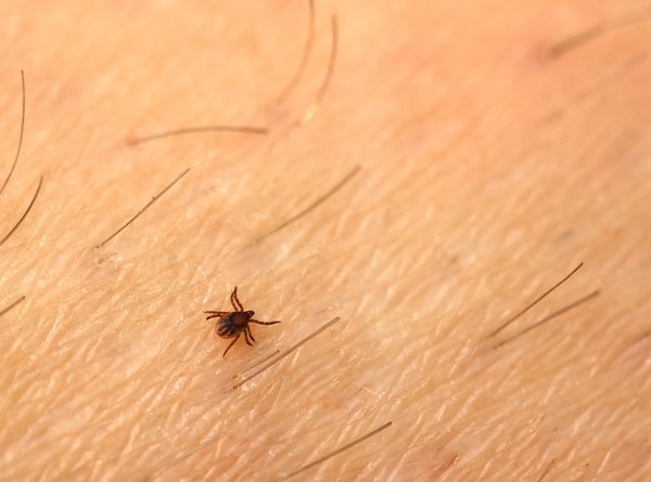 Close-up of black tick on skin
