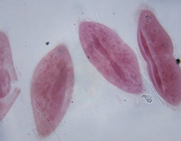 The paramecium swims by using its cilia like oars.