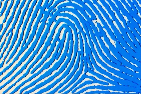 A radial loop pattern fingerprint