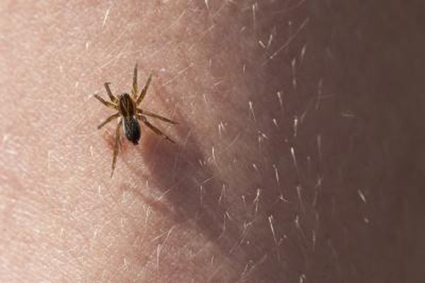 Photo Credit: gashgeron/iStock/Getty Images A brown recluse spider on skin.