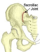 How to Cope with Sacroiliac Joint Pain | eHow