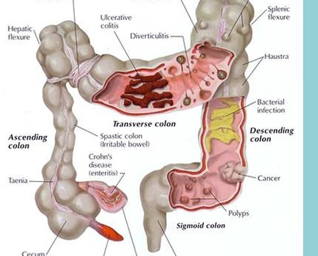 what-is-colon-hydrotherapy-leaftv