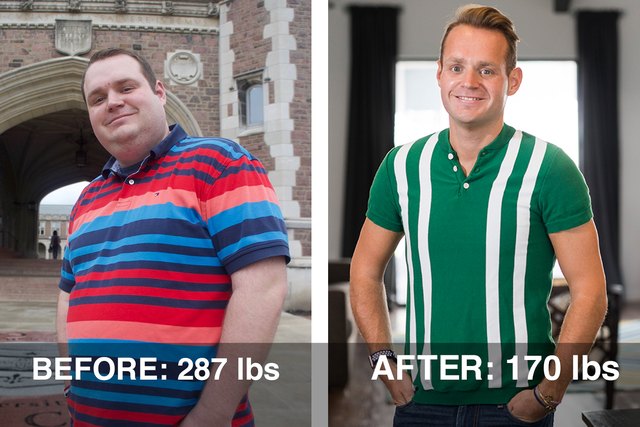 Pierre's before and after photos.