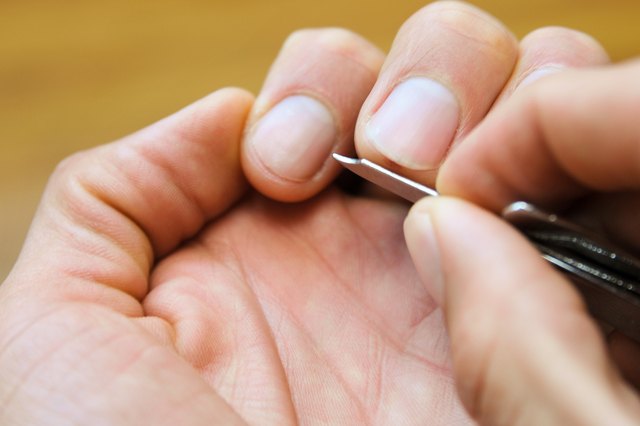 How to Get Rid of Common Warts Under the Nails | eHow