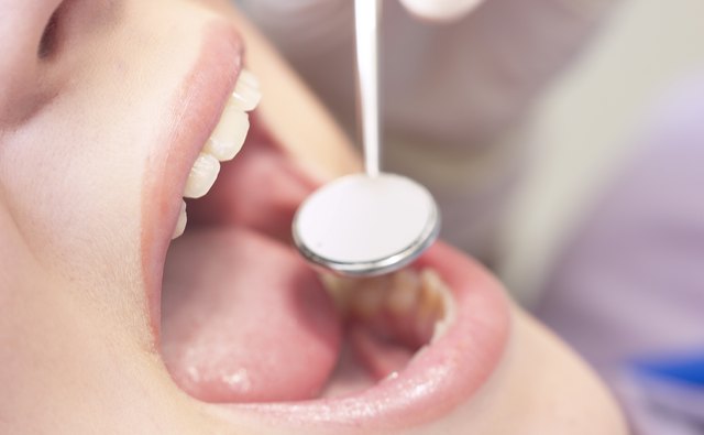 Dental hygiene