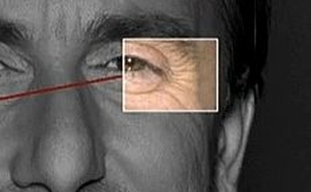 Crows Feet