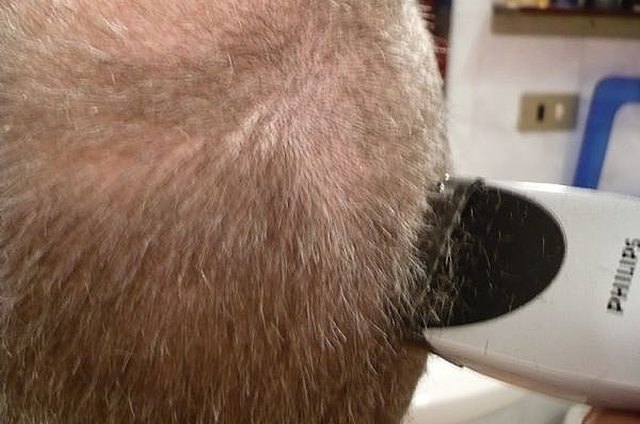 Medium How To Cut A Balding Man&#039;s Hair With Clippers for Men Haircut