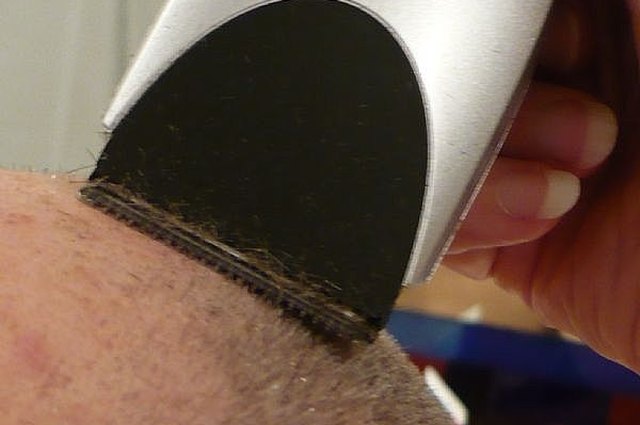 accidentally cut a mole while shaving accidentally cut a mole while shaving
