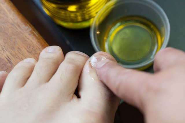 How to Get Rid of Brown Toenails | LEAFtv