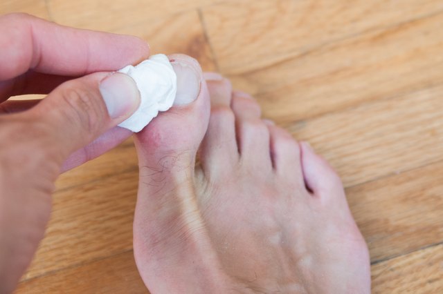 how-to-fix-a-split-toenail-leaftv