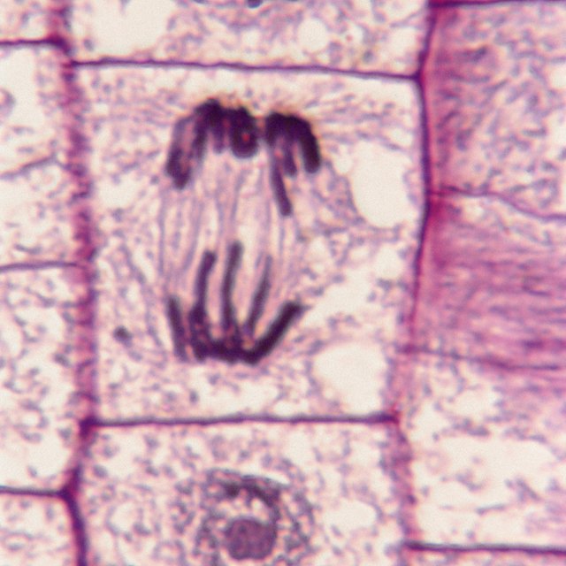 Stages of Mitosis (Cell Division) | Sciencing