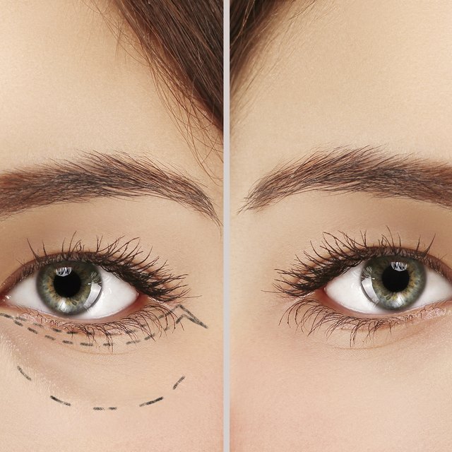 Tea Bags On Eyes : How to Conceal under eye puffiness and bags « Makeup