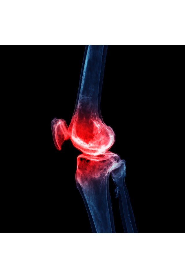 3d rendering of the knee joint  isolated on black background Showing pain area.