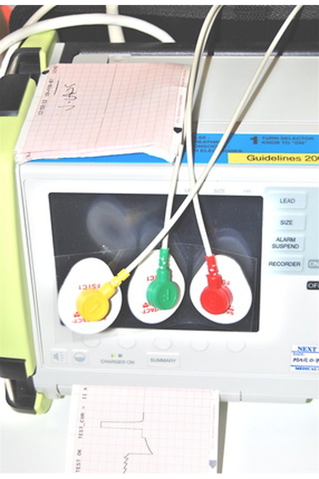 How to Use an ECG Machine