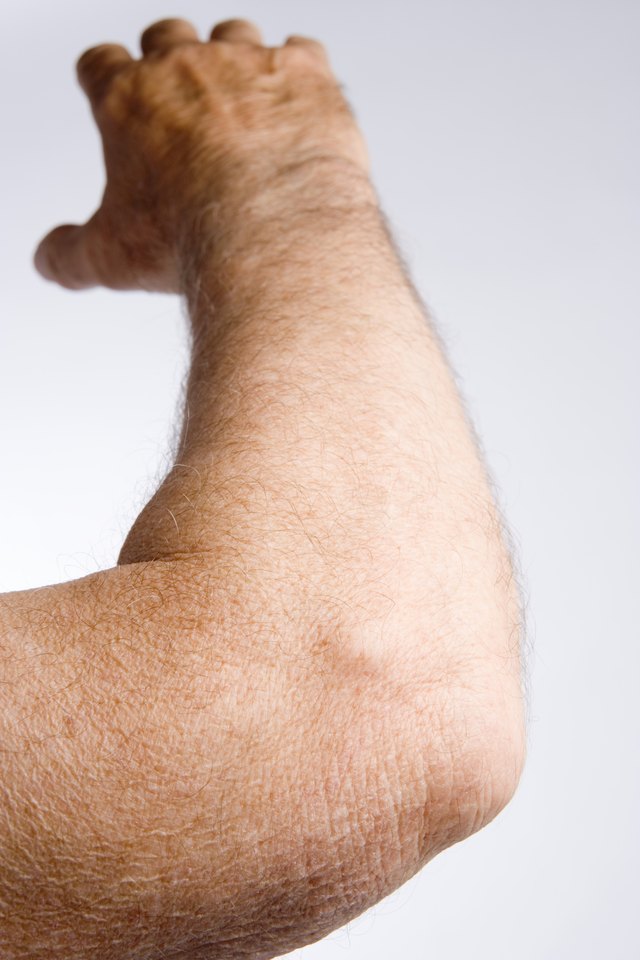 Man's elbow and arm