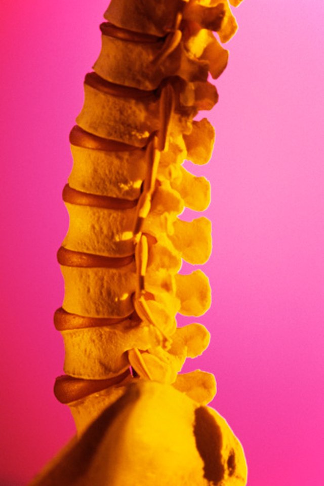 Exercises After Discectomy Surgery