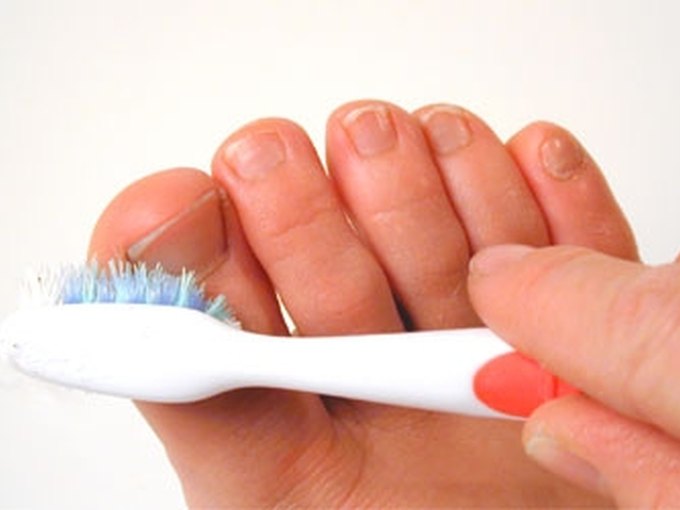 How to Treat Thick, Discolored Toenails LEAFtv