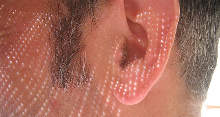 Vestibular Neuritis affects the inner ear