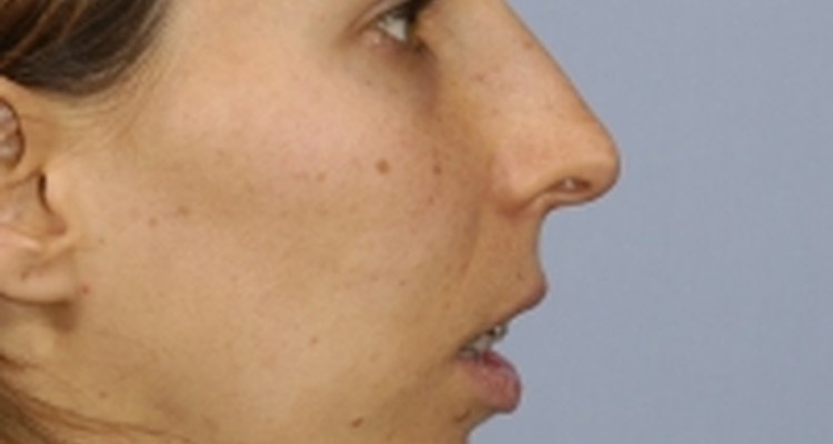Before: http://amazingfaces.com/gallery.php?ID=33&&