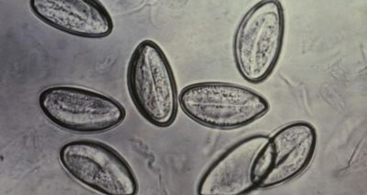 A magnified view of pinworm eggs.