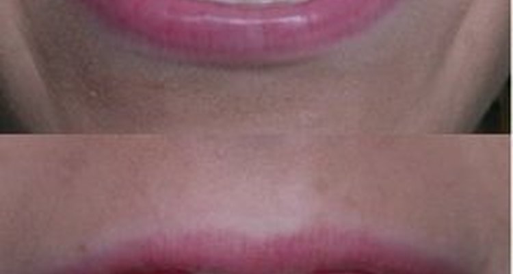 Tissue grafting and contouring can also resolve