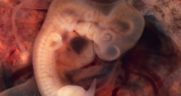 Embryo within oviduct of ectopic pregnancy