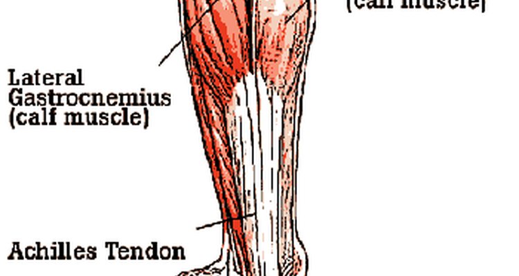 The Achilles tendon is the largest tendon in the body and is commonly injured (WebMD.com)
