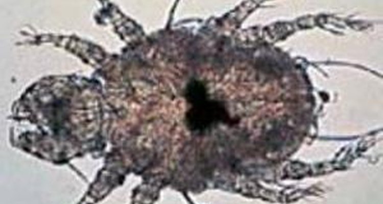 Mite that causes the rare but contagious walking dandruff.