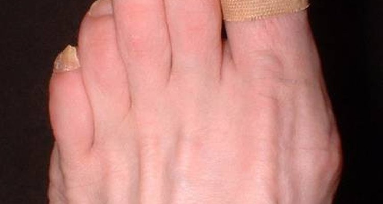 Cover coated nail with adhesive bandage
