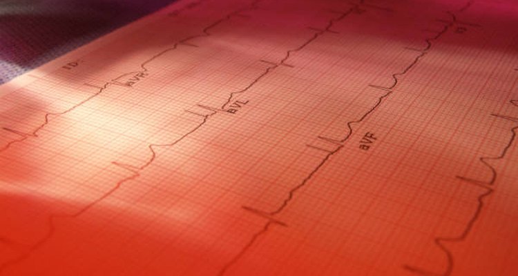 EKGs may be used to determine if a heart valve is leaking. Microsoft.com