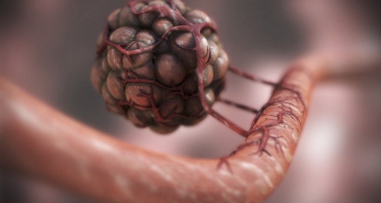 A main group of lymph nodes can be found around the neck.