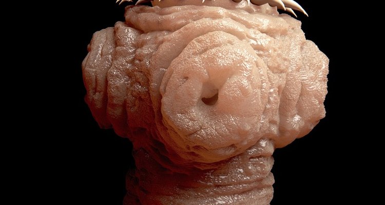 Tapeworm infestation can be the result of eating undercooked meat.