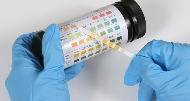 A variety of conditions can cause strong urine odour.