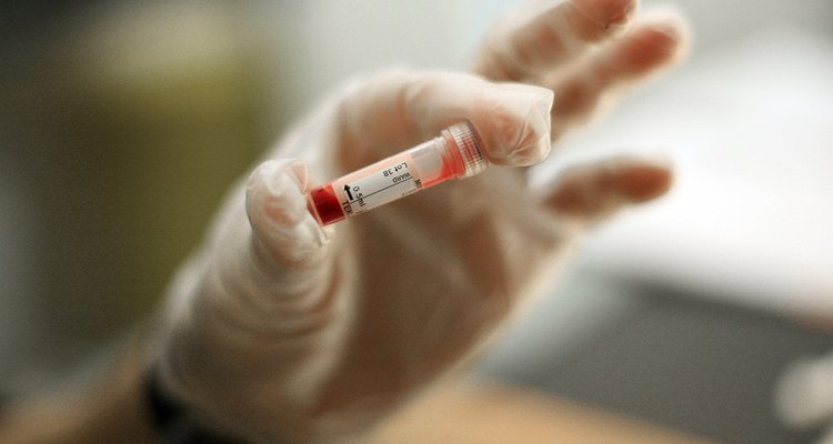 Fasting before a blood test can help ensure an accurate diagnosis.