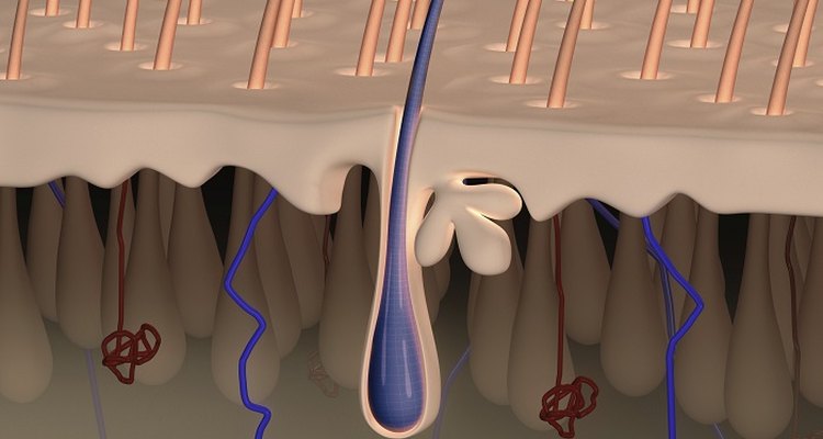 Dead skin and oily skin secretions can block hair follicles.