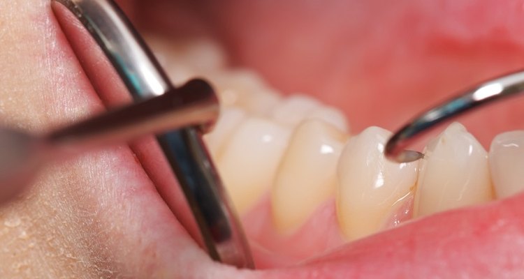 Many factors contribute to sore gums