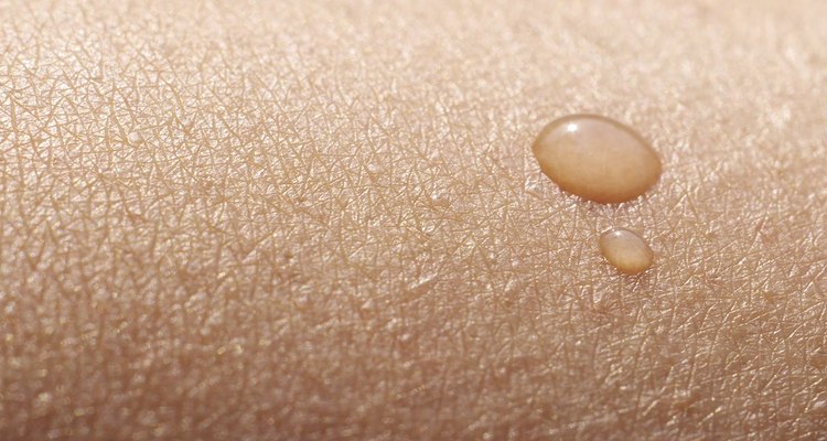 Healthy skin shows no sign of blood collecting beneath its surface.
