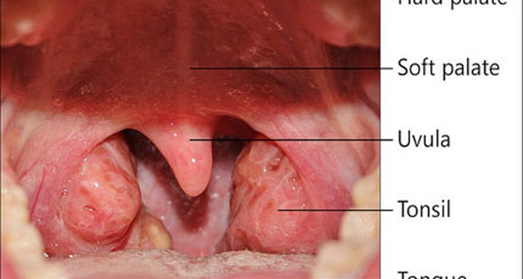 How Long Will Viral Tonsillitis Last