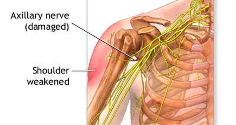 home-remedy-for-trapped-nerve-in-neck-homemade-ftempo