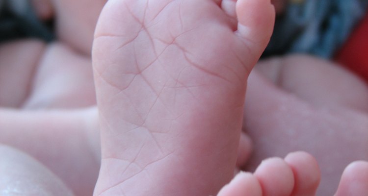 Staph infection causes in babies