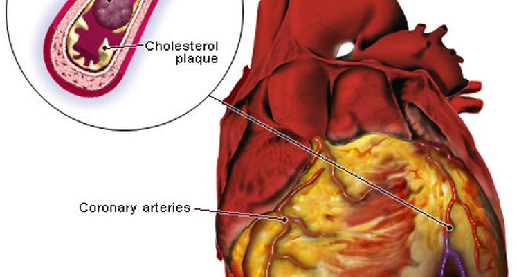 final-stages-of-congestive-heart-failure