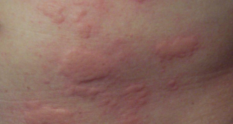 How To Diagnose A Skin Rash