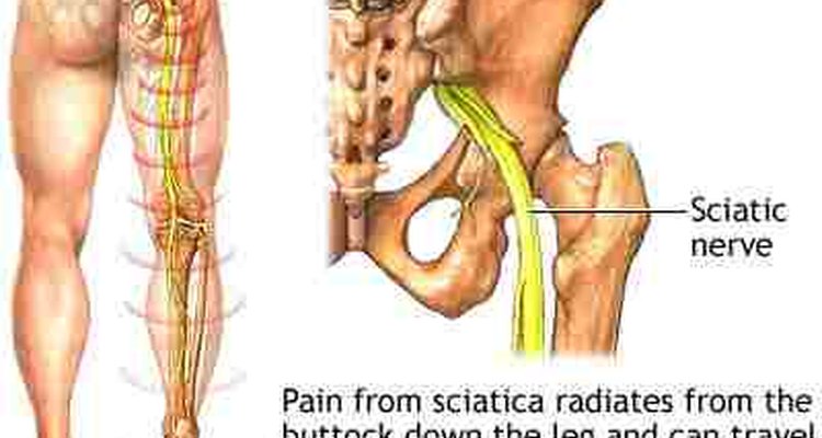 sciatic nerve pain relief remedies natural down nerves written july help butt runs