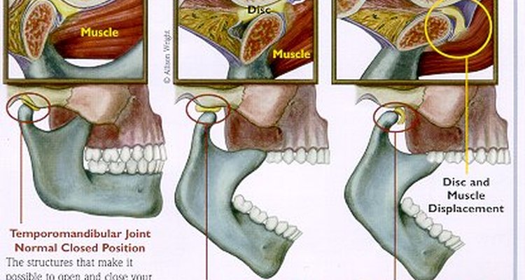 tmj-visual-symptoms