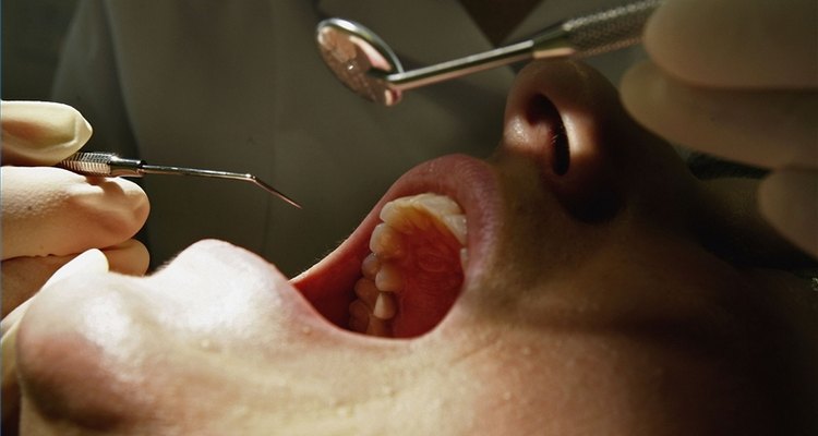 Temporarily Replace a Tooth Filling