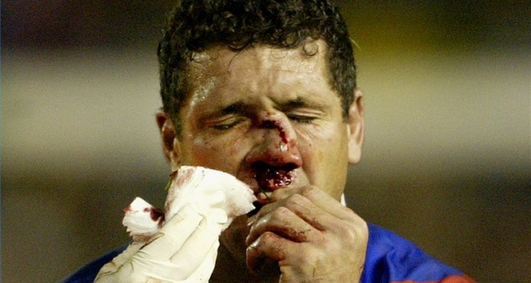 Treat a Broken Nose