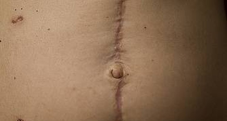Cirurgia abdominal