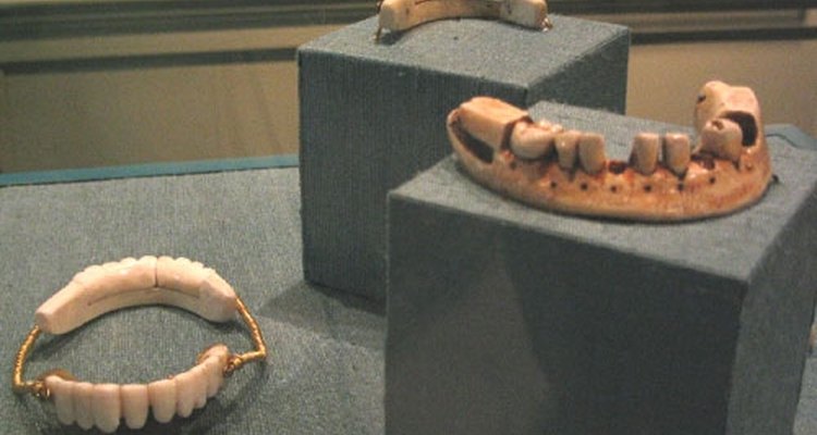 Historiadores confirmam que as dentaduras têm sido utilizadas para substituir dentes perdidos desde, pelo menos, 700 a.C.